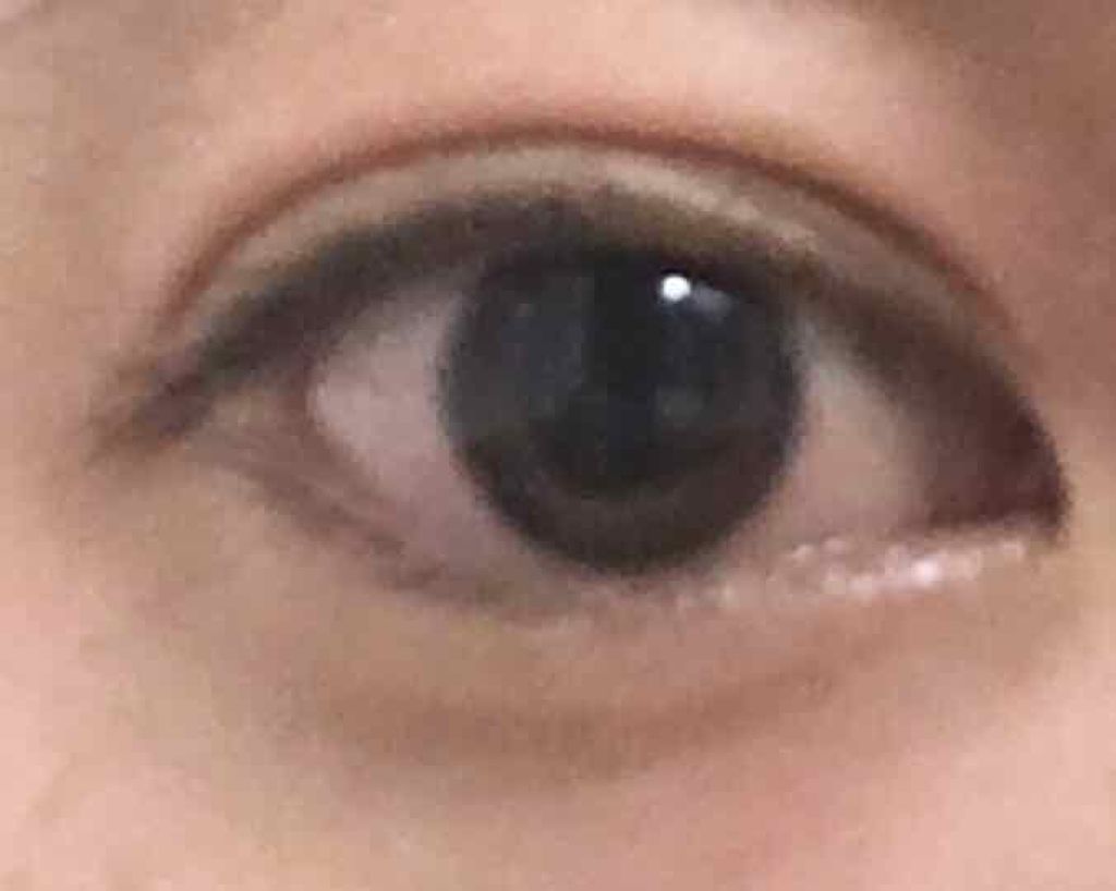 sparkle_gloss_hedult on LIPS 「2枚目本人画像注意⛑誰かアドバイスください、、2枚目の私の写真..」(2枚目)