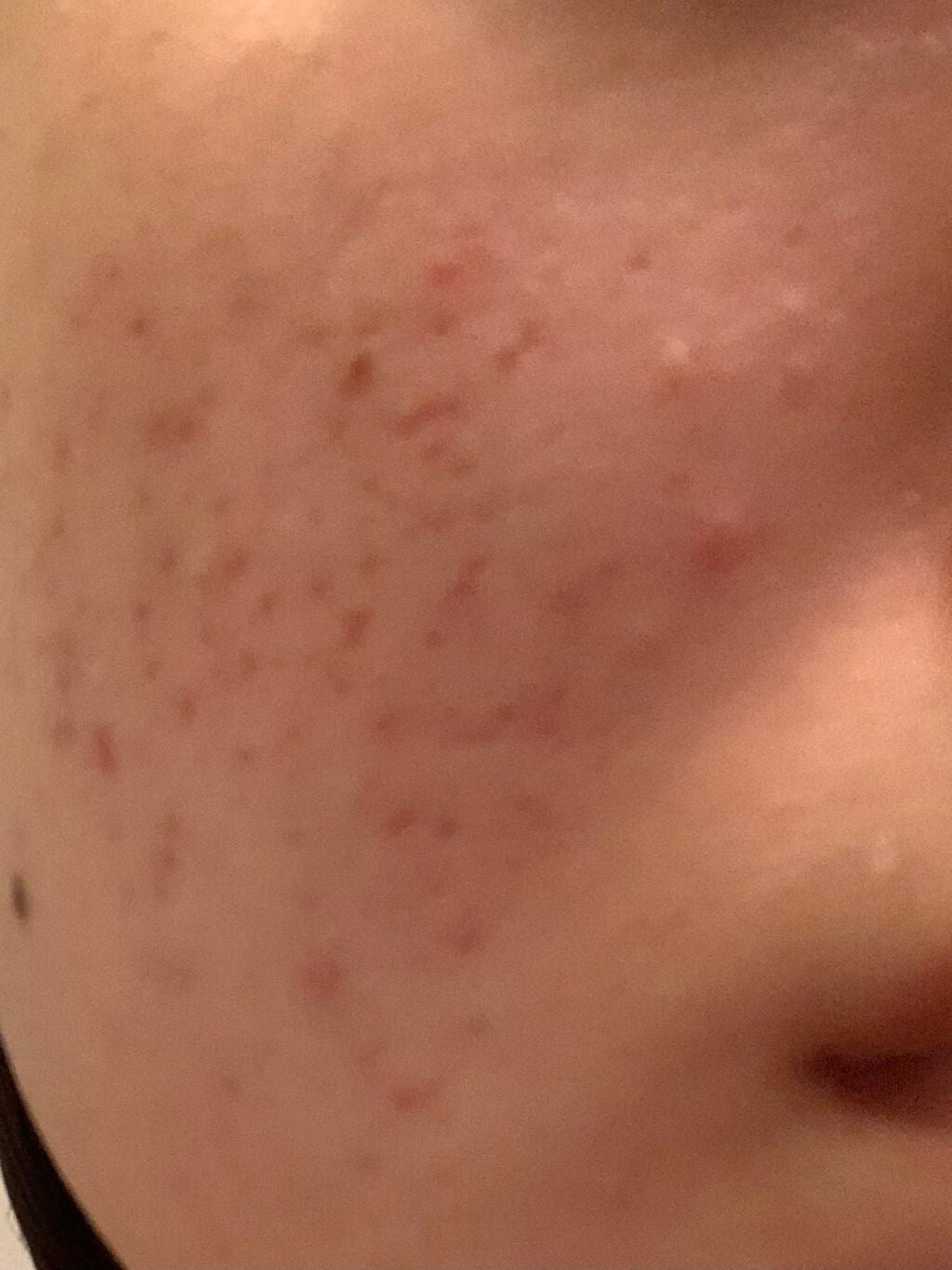 ð¶ð» on LIPS ãïŒæç®é²èŠ§æ³šæã§ãïŒïŒïŒå©ããŠãã ããïŒïŒïŒé·å¹Žãããã«æ©ãã§..ãïŒ2æç®ïŒ