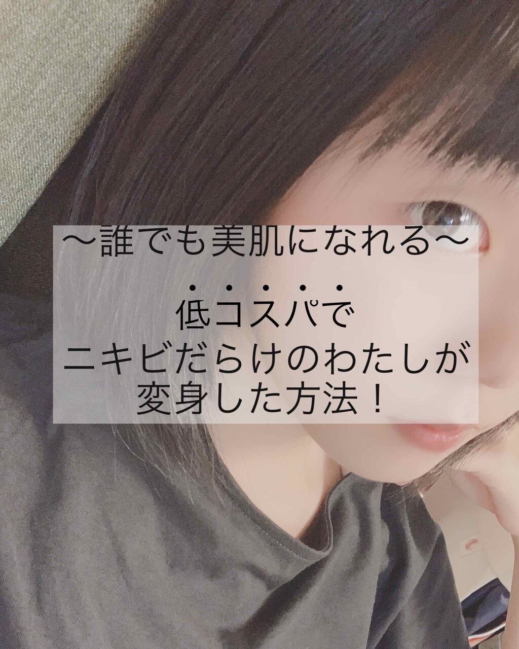 美白化粧水 VC/ちふれ/化粧水を使ったクチコミ(1枚目)