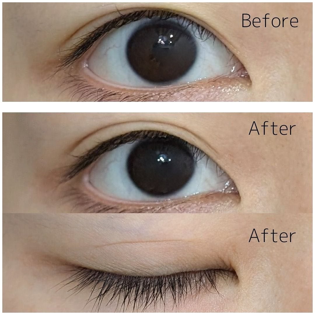 メザイク クリップ カッター ファイバー専用カッター/メザイク/二重まぶた用アイテムを使ったクチコミ(6枚目)