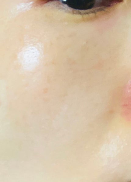 黒真珠マスク/我的美麗日記/シートマスク・パックを使ったクチコミ(4枚目)