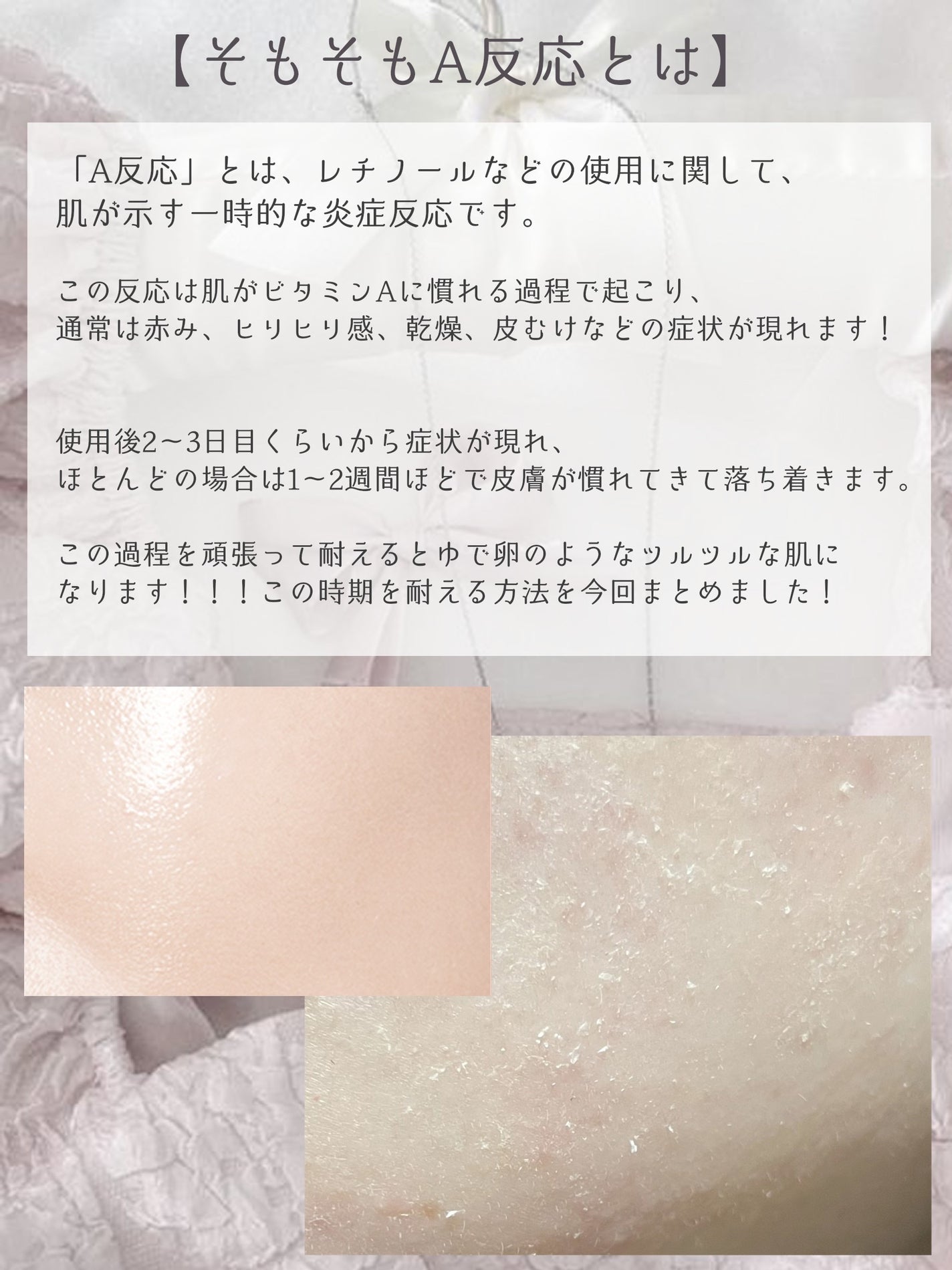 めくれるふきとりコットン/オードムーゲ/コットンを使ったクチコミ(3枚目)