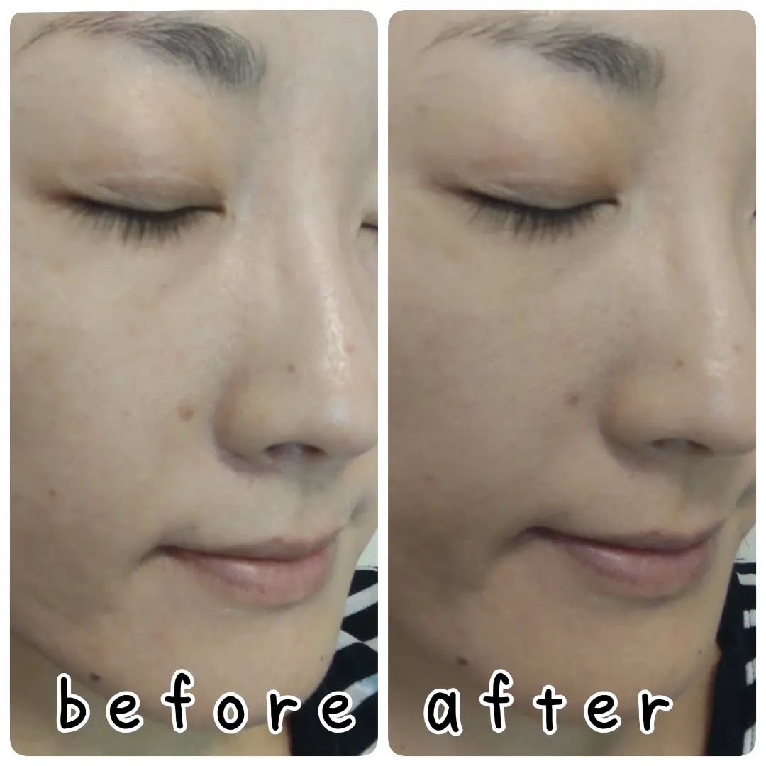 タンイドル ウルトラ ウェア リキッド N/LANCOME/リキッドファンデーションを使ったクチコミ（3枚目）