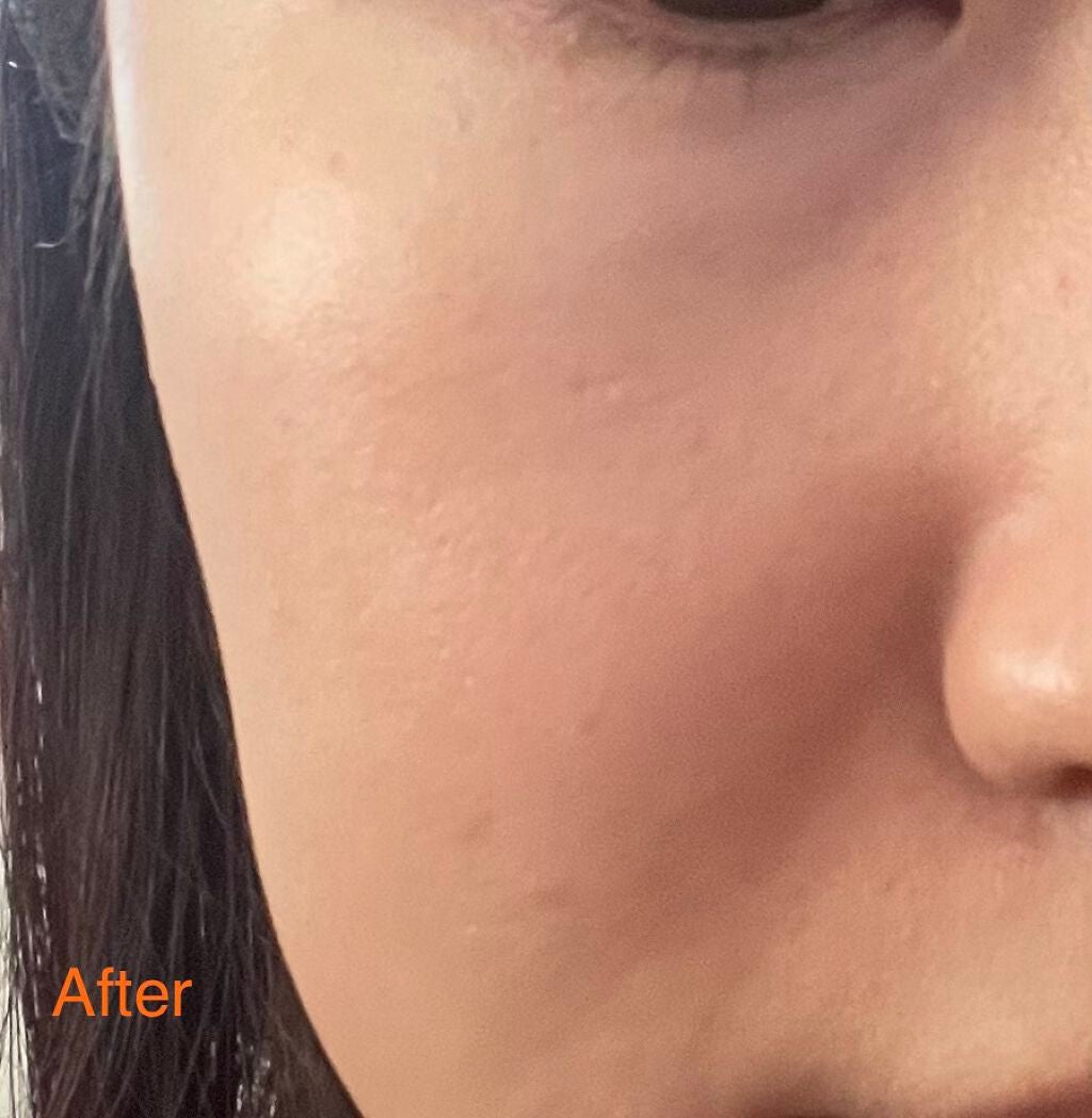 プロフィニッシュリキッド/インテグレート/リキッドファンデーションを使ったクチコミ(3枚目)