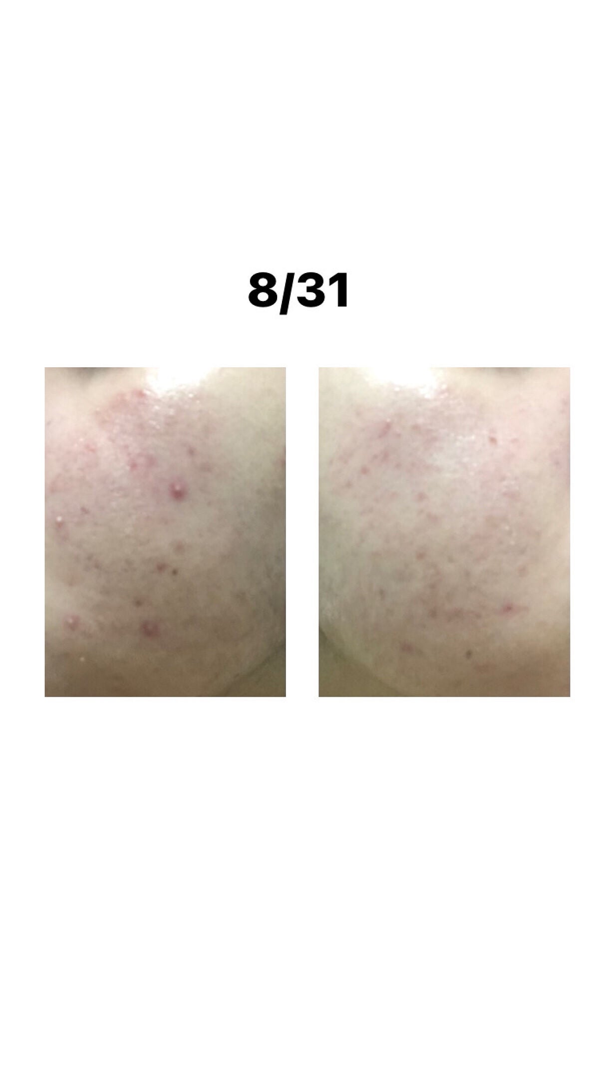 もちお on LIPS 「こんにちは☀️もちおですいつ買ったのか覚えてない大容量パックを..」(2枚目)