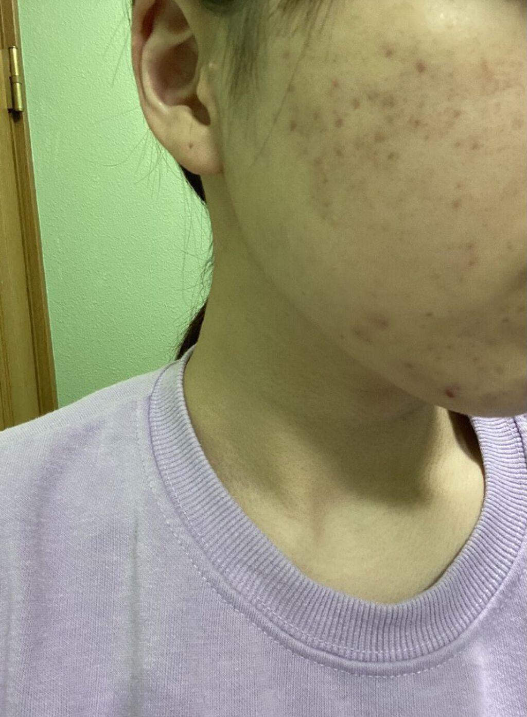 Alpha Arbutin 2% + HA/The Ordinary/フェイスオイルを使ったクチコミ（1枚目）