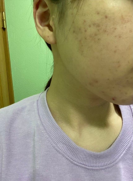 フローラドリップ/ALBION/化粧水を使ったクチコミ(1枚目)