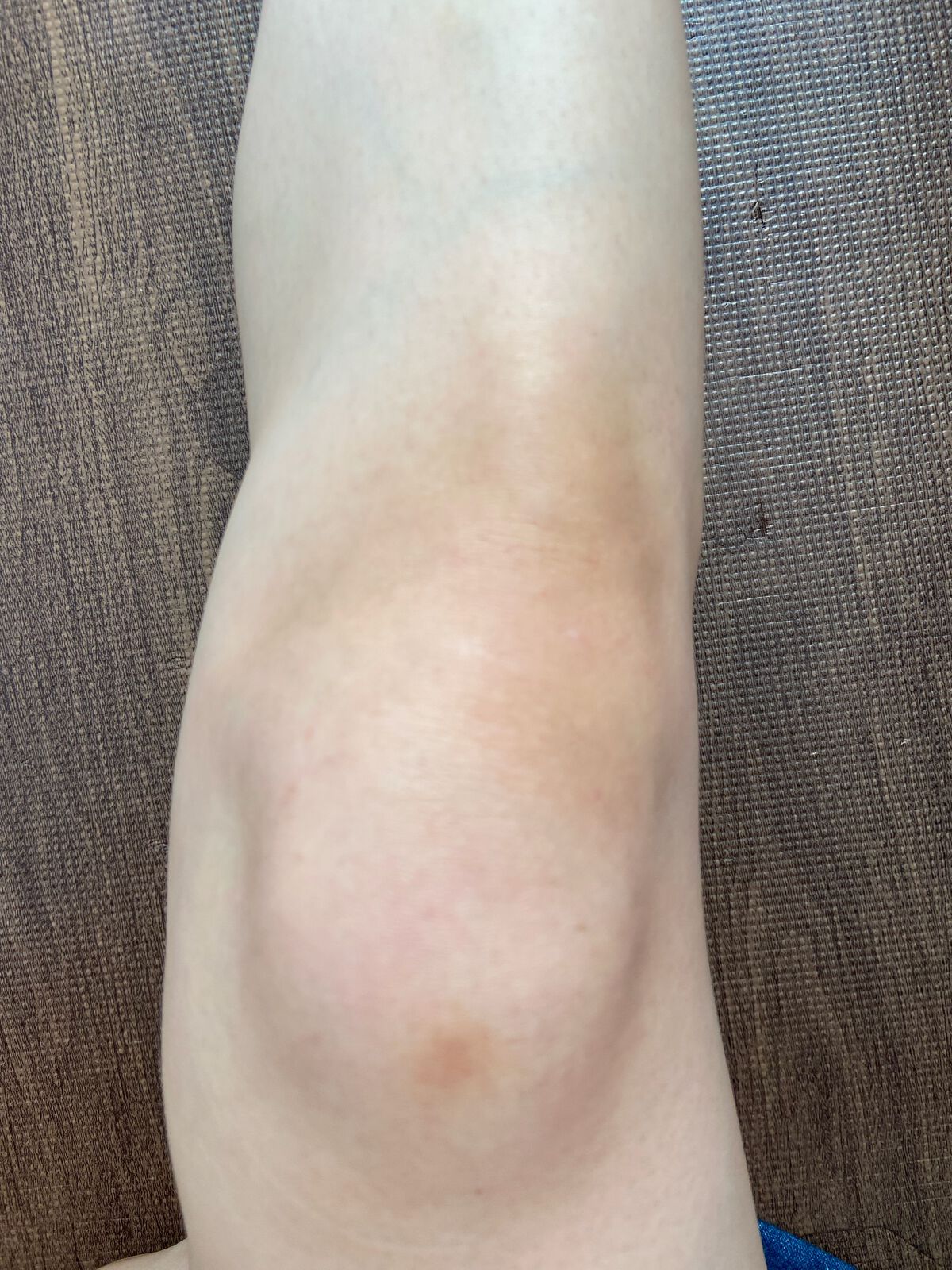 スキンスムーススクラブジェル/Beaumit/スクラブ・ゴマージュを使ったクチコミ(6枚目)