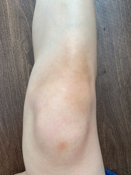 スキンスムーススクラブジェル/Beaumit/スクラブ・ゴマージュを使ったクチコミ(6枚目)