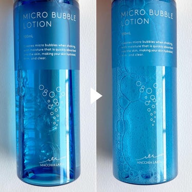 薬用マイクロバブルローション/Macchia Label/化粧水を使ったクチコミ（3枚目）