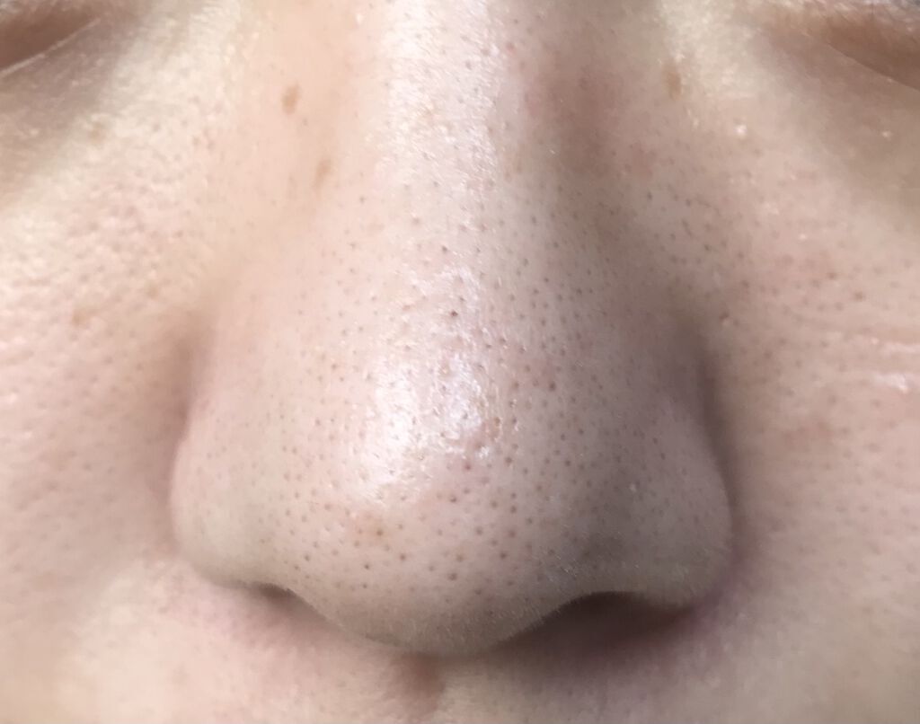 ノーモアブラックヘッド(ノーズピーリング)/One-day's you/スクラブ・ゴマージュを使ったクチコミ（3枚目）