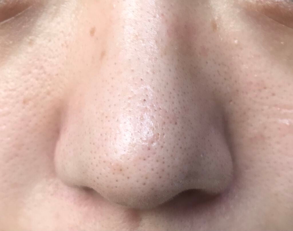 ノーモアブラックヘッド(ノーズピーリング)/One-day's you/スクラブ・ゴマージュを使ったクチコミ(3枚目)