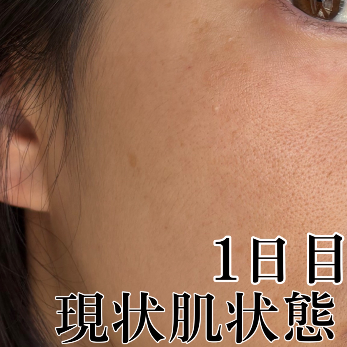 TXトーニングトナー/VT/化粧水を使ったクチコミ（2枚目）