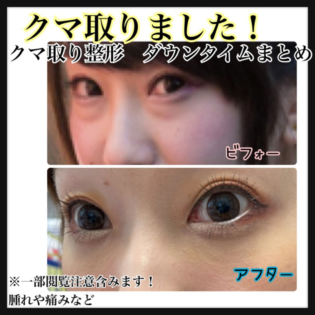 ディエム クルール カラーブレンドパウダーコンシーラー/ディエム クルール/パウダーコンシーラーを使ったクチコミ（1枚目）