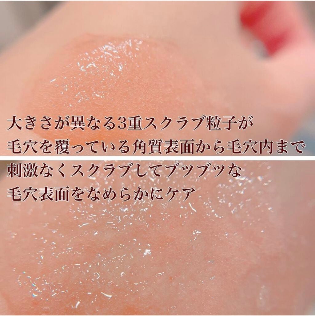 レッドシカボディスクラブ/MEDICUBE/ボディスクラブを使ったクチコミ(3枚目)