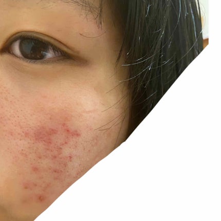 ロゼット 洗顔パスタ 荒性肌/ロゼット/洗顔フォームを使ったクチコミ(2枚目)