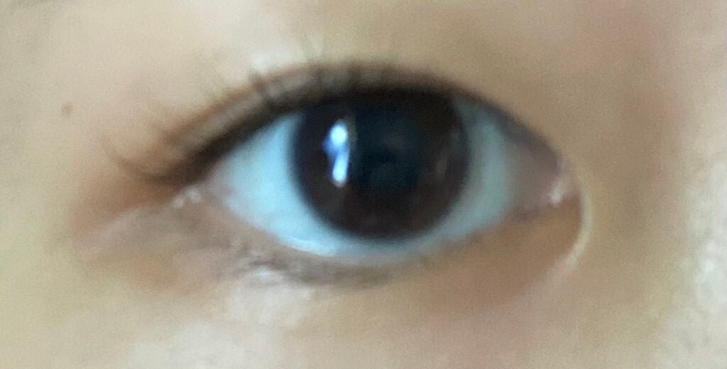 あい on LIPS 「こういった蒙古襞があって奥二重の場合二重にどうすればなりますか..」(1枚目)