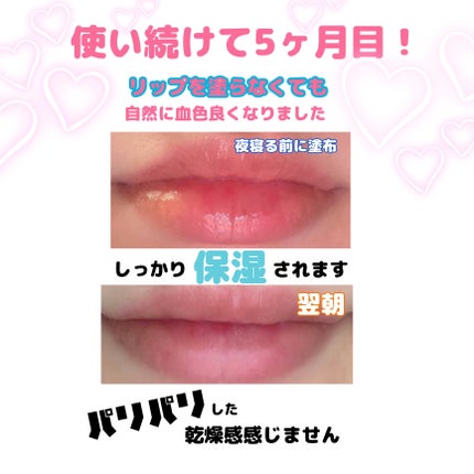 トータルモイストベール リップエッセンス/アルージェ/リップ美容液を使ったクチコミ(3枚目)