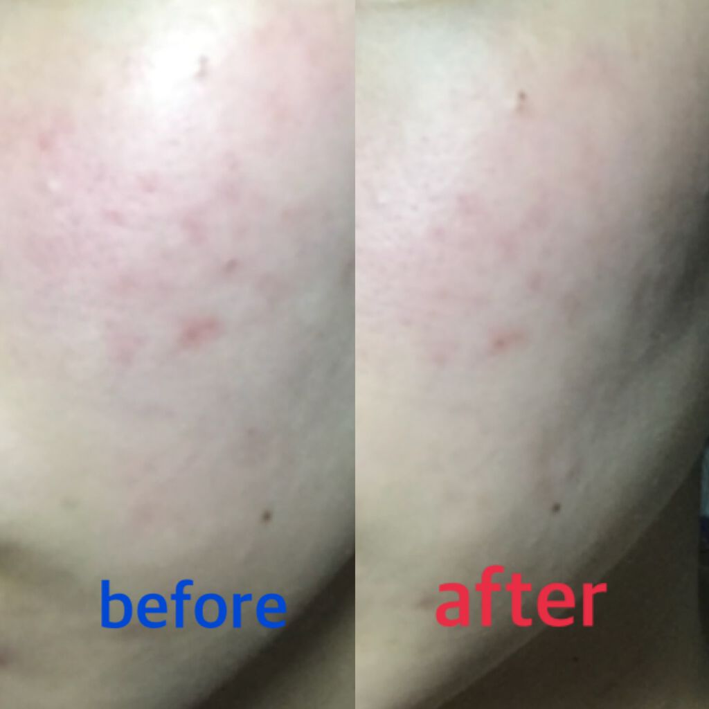 ãããããšã±ã¢ãžã§ã«/ã¢ãããã³/ãã®ä»ã¹ãã³ã±ã¢ã䜿ã£ãã¯ãã³ãïŒ3æç®ïŒ