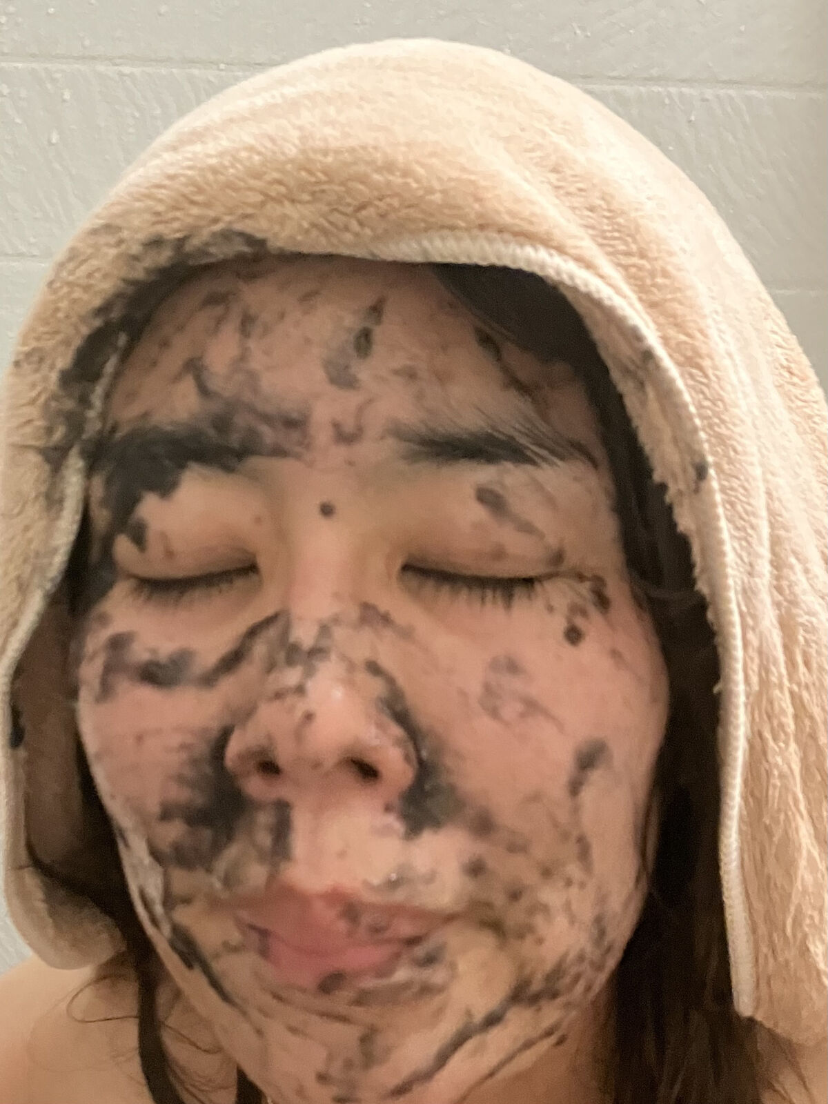 ニードル炭酸パック/NNE/洗い流すパック・マスクを使ったクチコミ（3枚目）