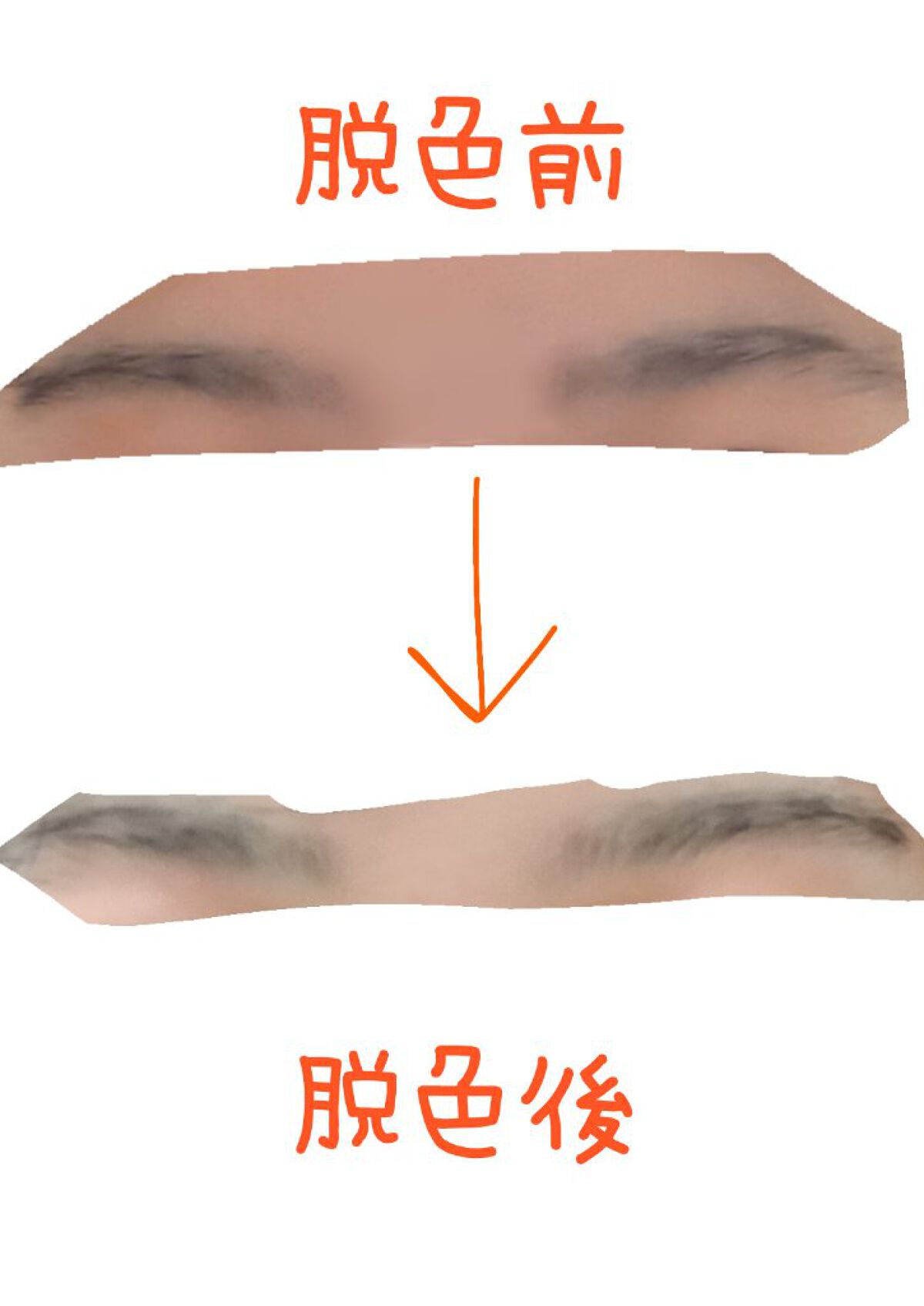 脱色クリーム 敏感肌用/エピラット/ムダ毛ケアを使ったクチコミ（2枚目）