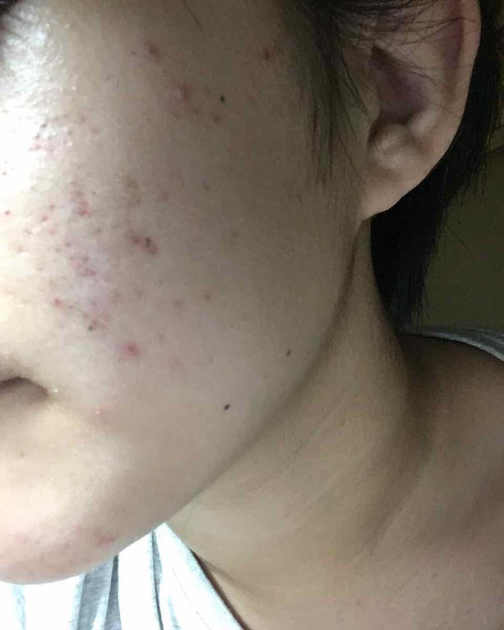 薬用 しみ 集中対策 美容液/メラノCC/美容液を使ったクチコミ（2枚目）