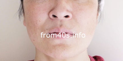 リソウ クリア シールド VBR/リソウコーポレーション/化粧下地を使ったクチコミ(3枚目)