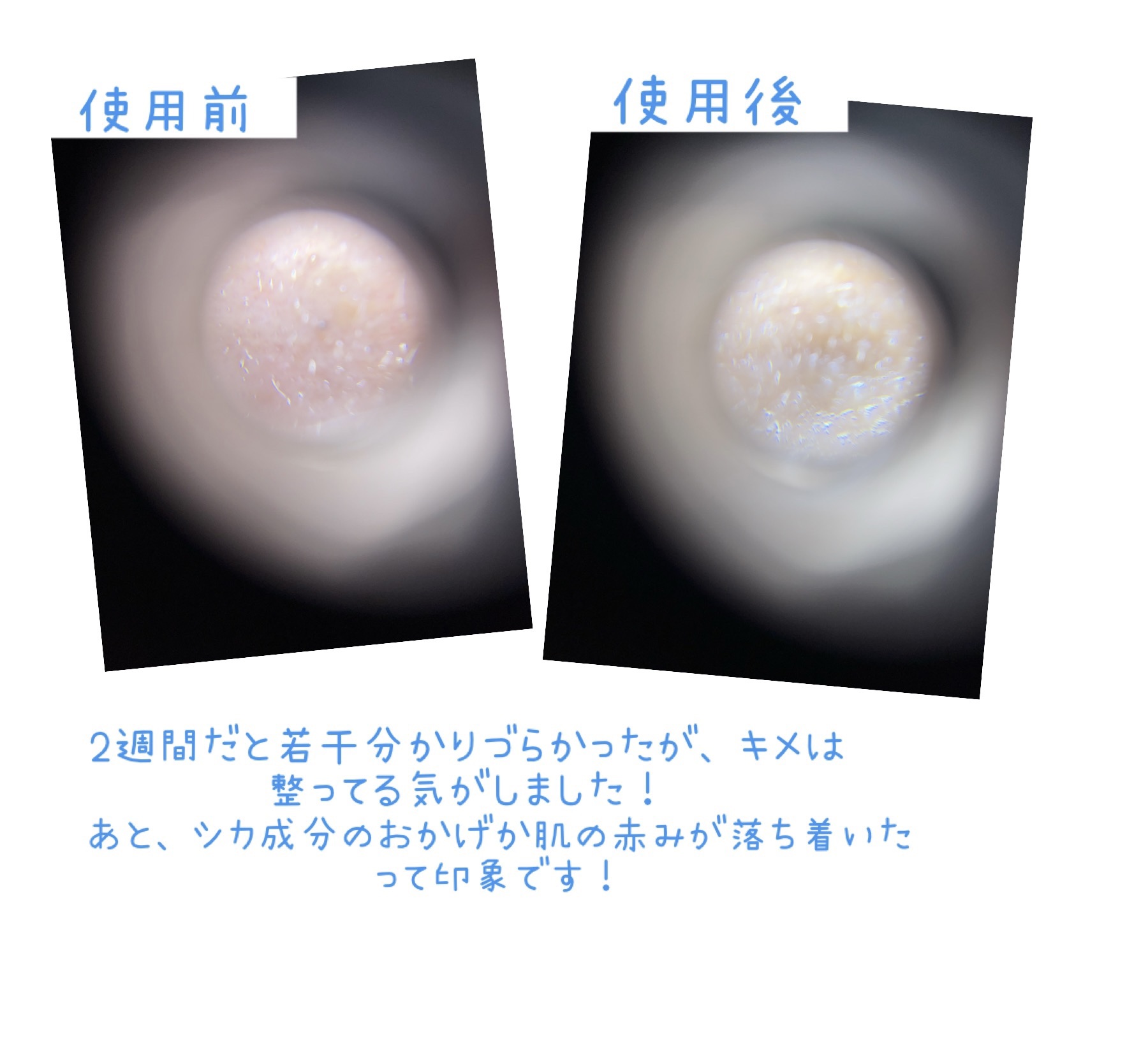 プロCICAリードルショット100/VT/ブースター・導入液を使ったクチコミ（3枚目）