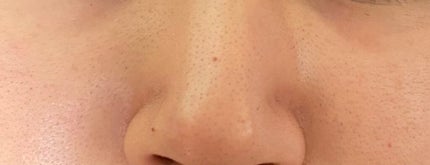 オバジC 酵素洗顔パウダー/オバジ/洗顔パウダーを使ったクチコミ(3枚目)