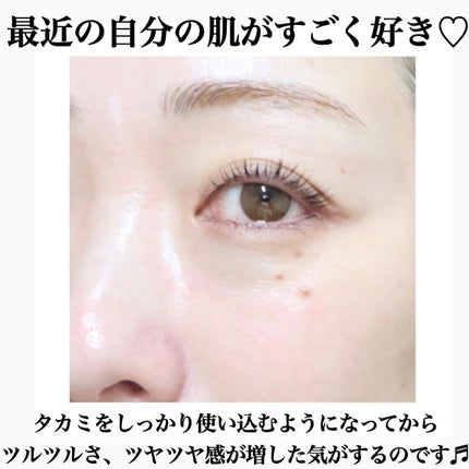 タカミスキンピール/タカミ/ブースター・導入液を使ったクチコミ(1枚目)