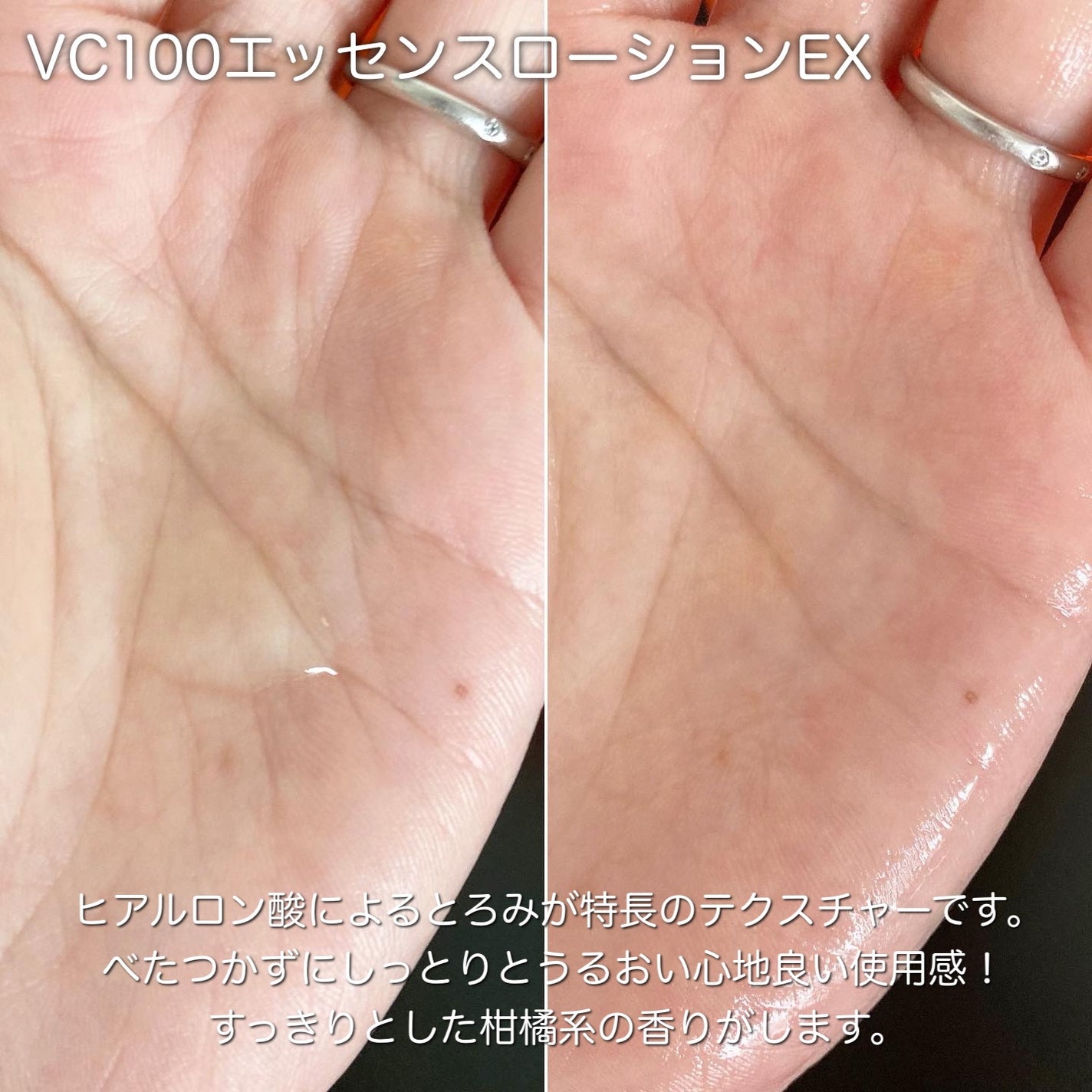 VC100エッセンスローション EX/ドクターシーラボⓇ/化粧水を使ったクチコミ(2枚目)