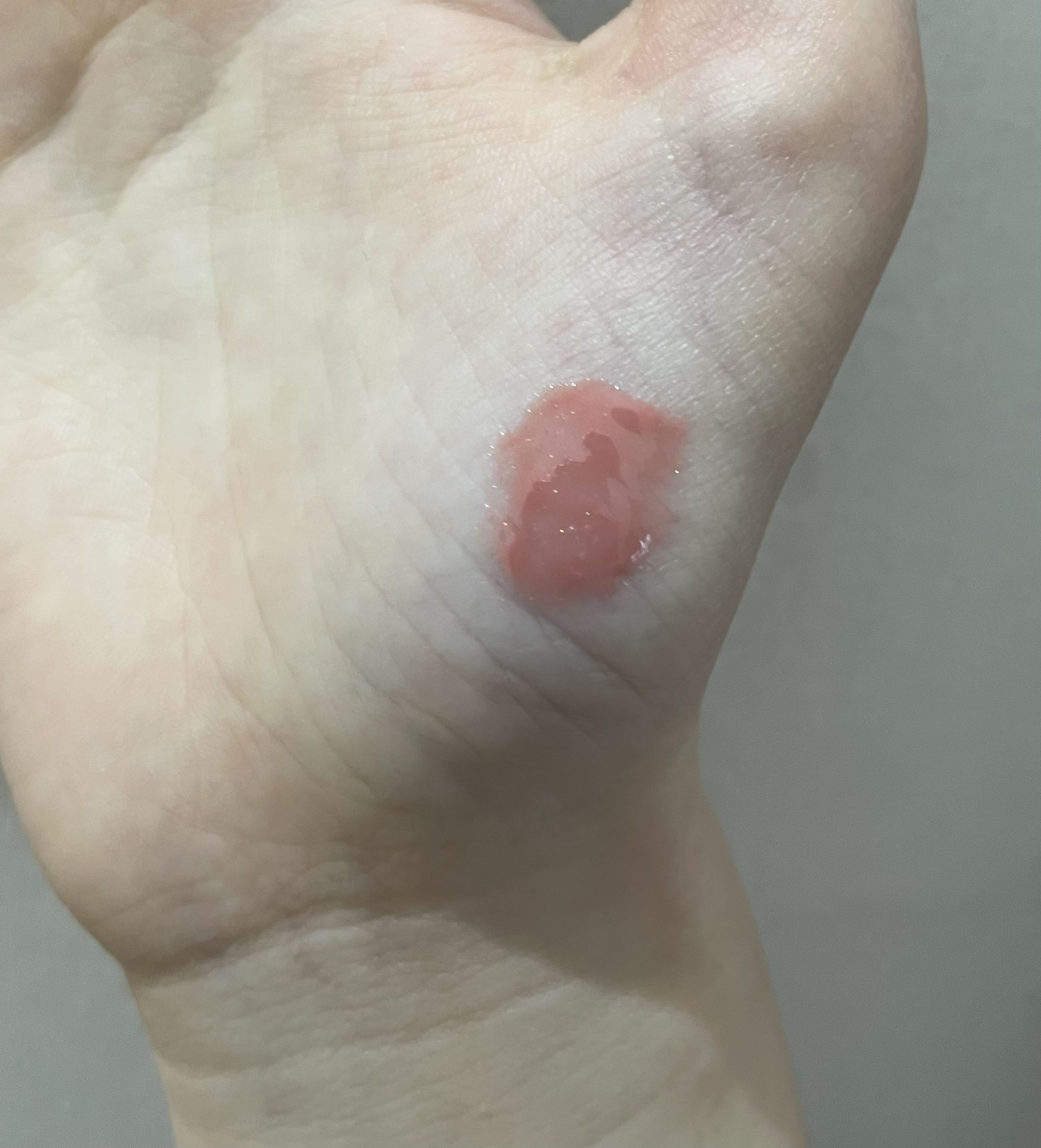 エッセンス リッププランパー/Visée/リッププランパーを使ったクチコミ（2枚目）