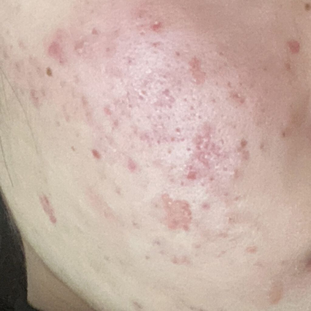 極潤 ヒアルロン泡洗顔/肌ラボ/泡洗顔を使ったクチコミ（1枚目）