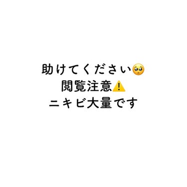 アポスティークリーム(医薬品)/アポスティー/その他を使ったクチコミ（1枚目）