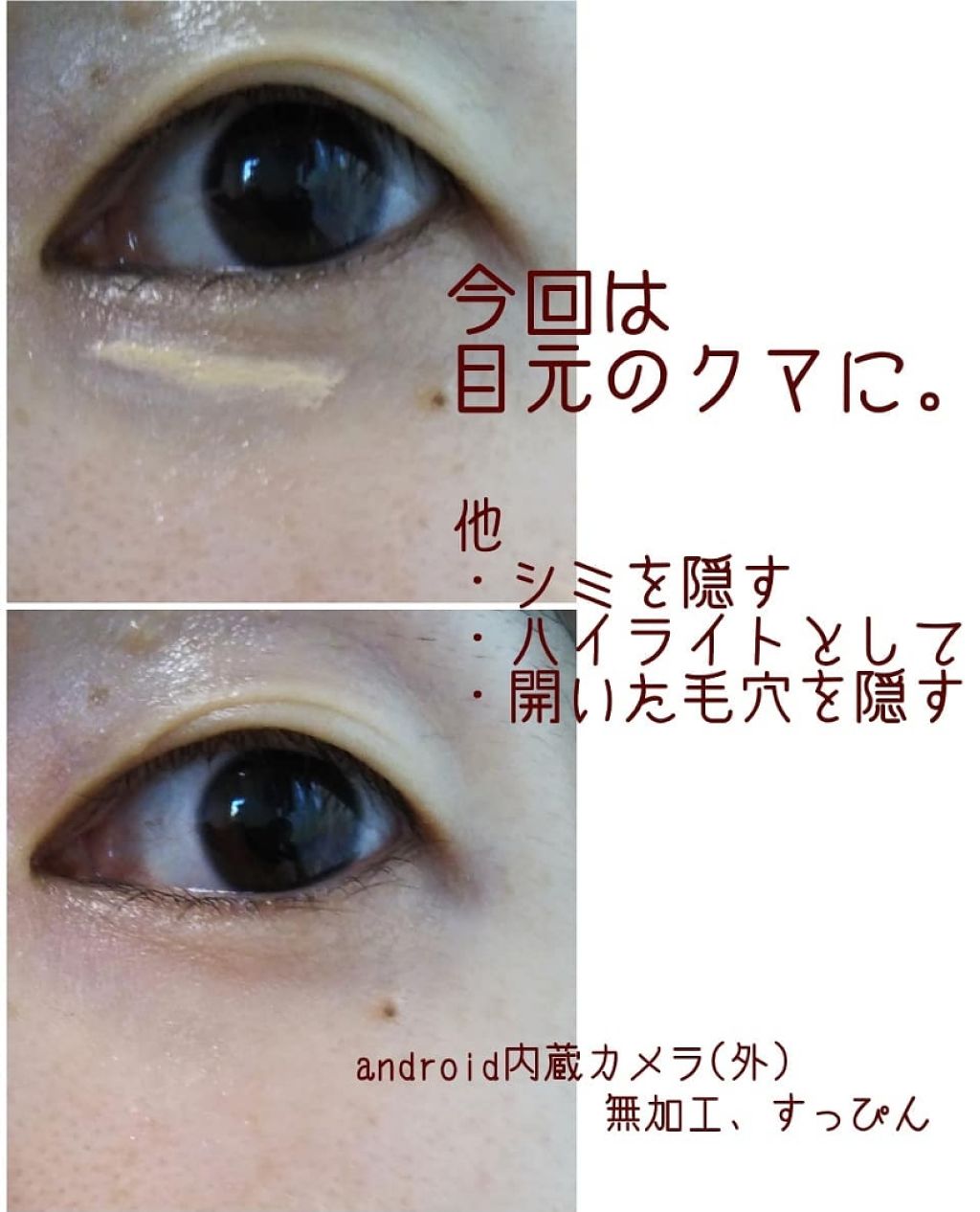 アイプリン EYE PUDDING レスプロンド Resplend 2ml 1本 美容液