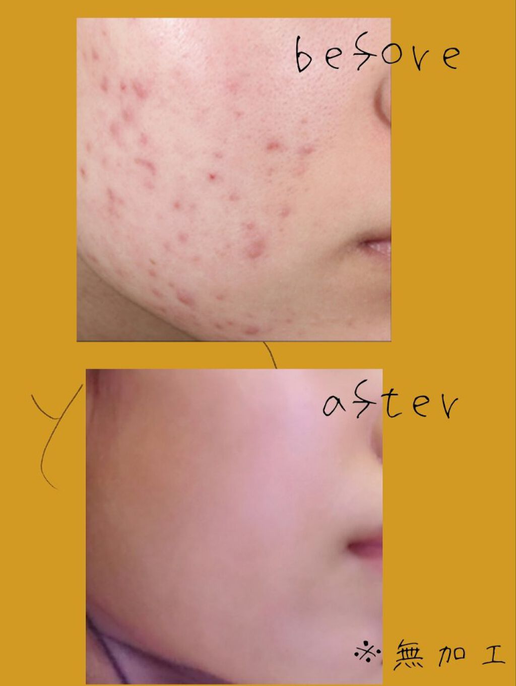 乳液・敏感肌用・さっぱりタイプ/無印良品/乳液を使ったクチコミ（2枚目）