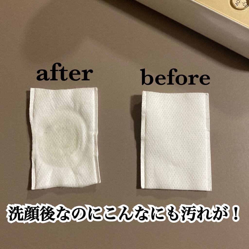 RFボーテ フォトPLUS EX/YA-MAN TOKYO JAPAN/美顔器・マッサージを使ったクチコミ（3枚目）