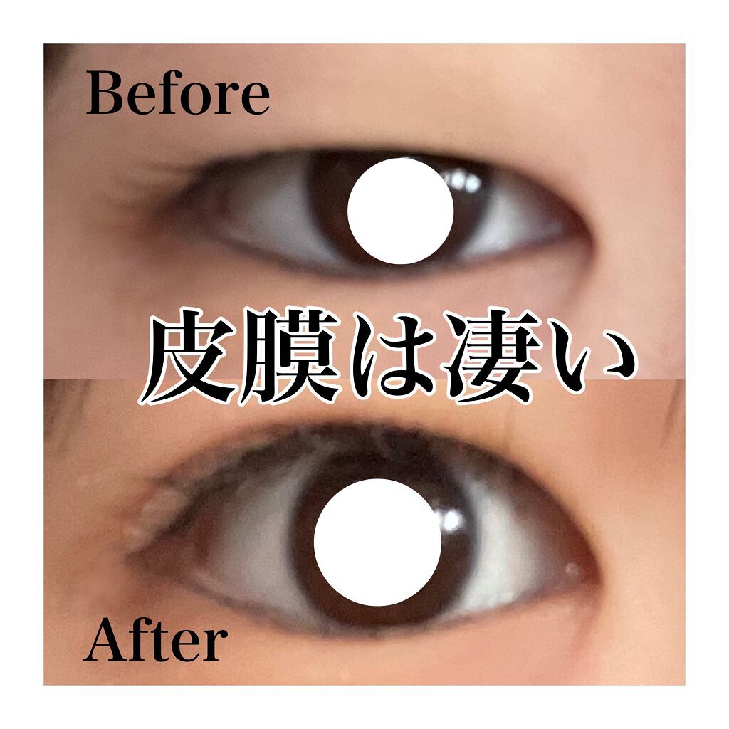 TWOOLダブルアイリッドハイブリットフィルム/SHOBIDO/二重まぶた用アイテムを使ったクチコミ(1枚目)