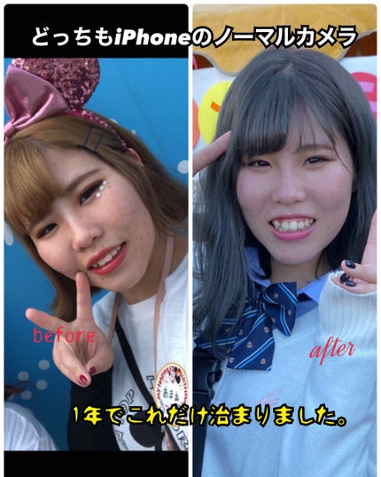 ブライトピュアベース/CandyDoll/化粧下地を使ったクチコミ(2枚目)