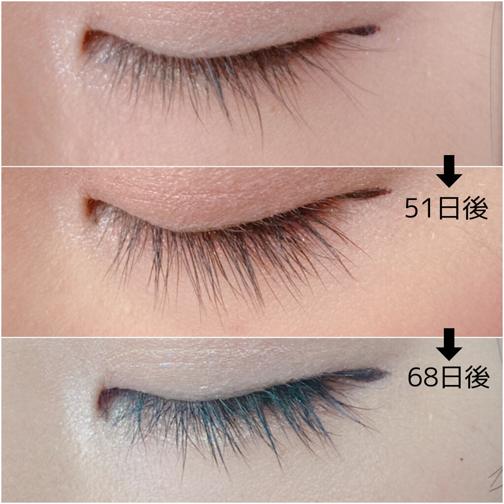 ラッシュアディクト アイラッシュコンディショニングセラム/soaddicted/まつげ美容液を使ったクチコミ（2枚目）