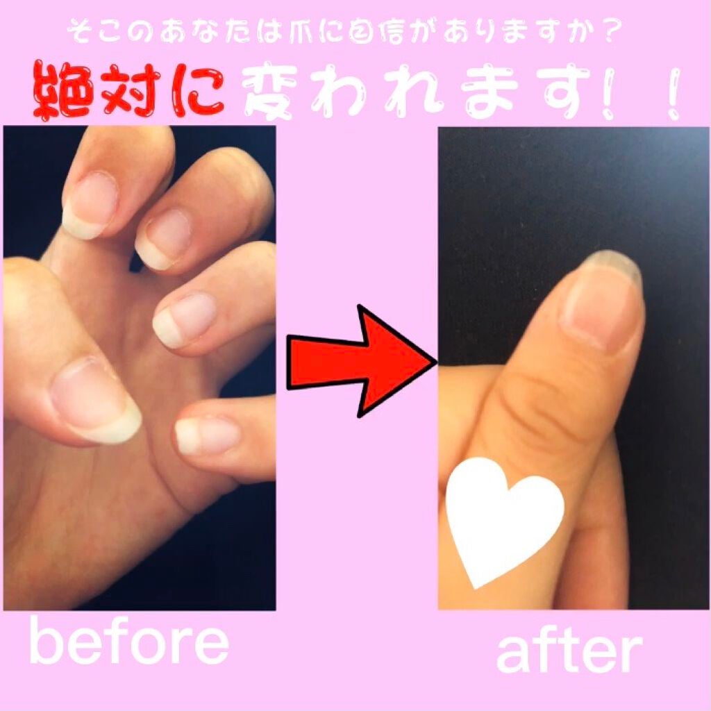 オリジナル ピュアスキンジェリー/ヴァセリン/ボディクリームを使ったクチコミ(1枚目)