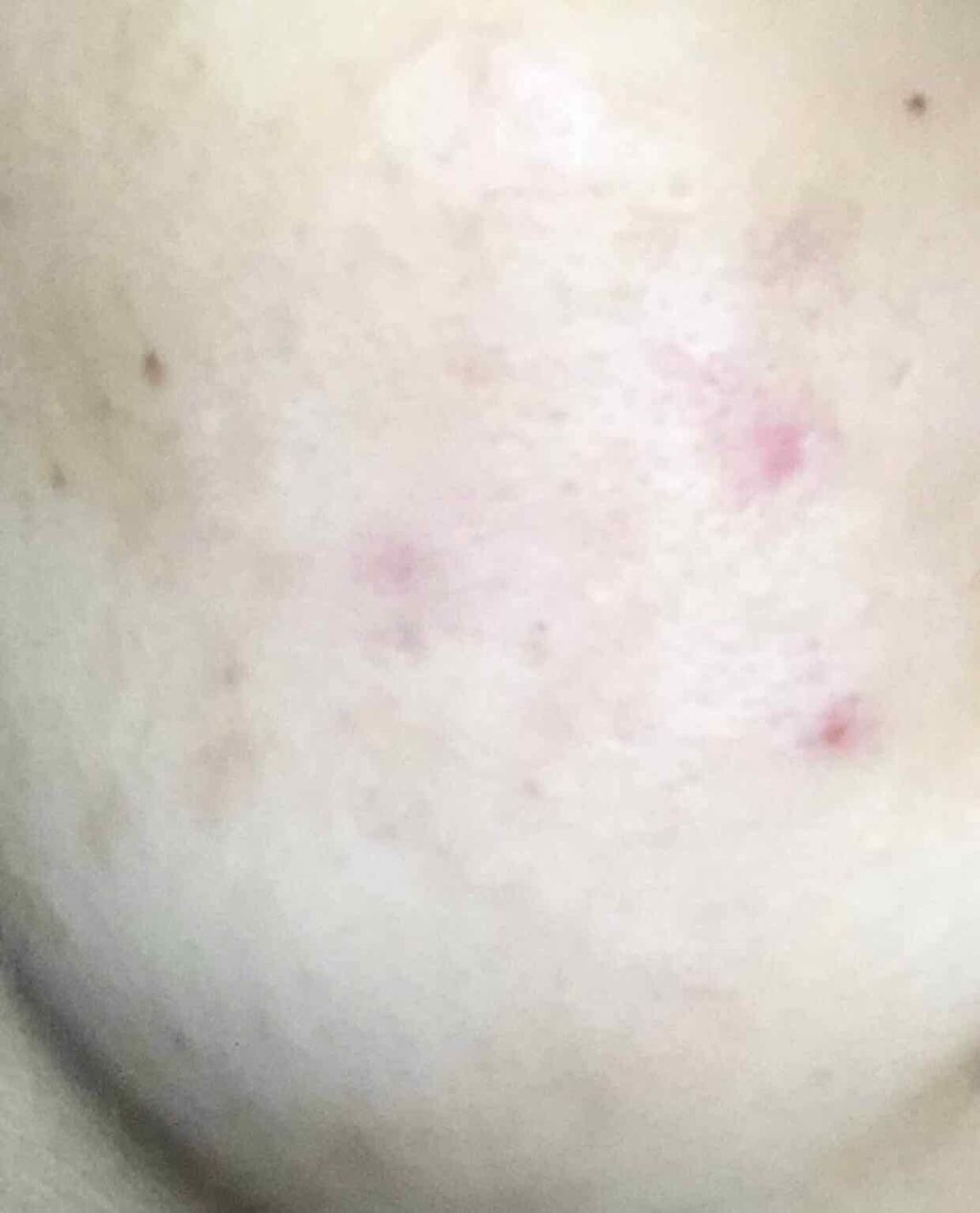 ハトムギ化粧水(ナチュリエ スキンコンディショナー R )/ナチュリエ/化粧水を使ったクチコミ（1枚目）