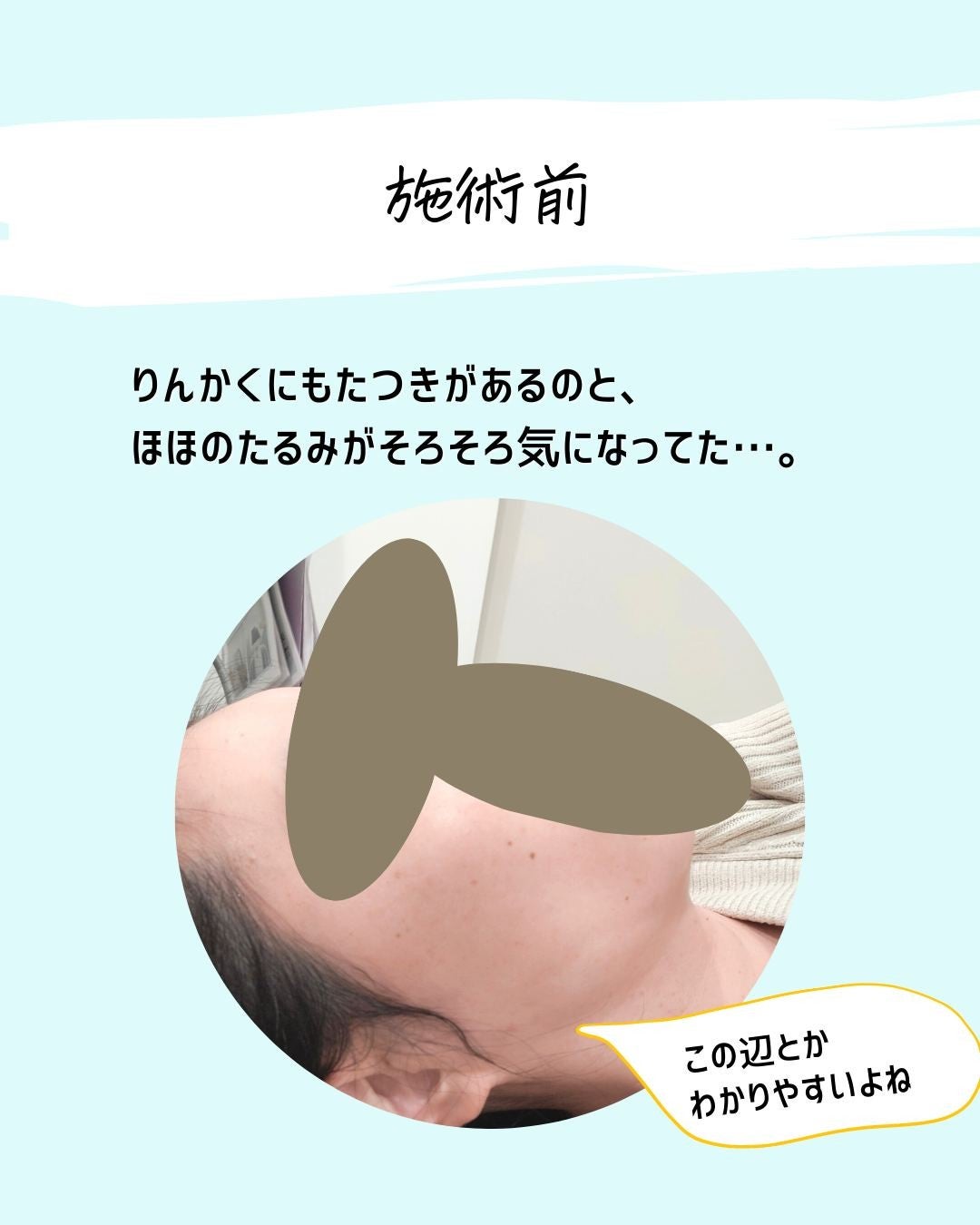 とまと村長@化粧品研究者 on LIPS 「←肌ケアをしたい人はフォロー必須🍅化粧品研究者のとまと村長です..」(5枚目)