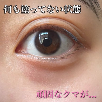 薬用 スキンケア&カバーチューブ/d プログラム/クリームコンシーラーを使ったクチコミ(6枚目)