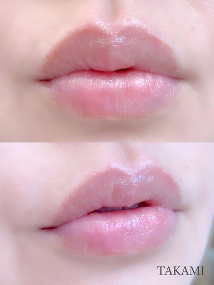 タカミリップ/タカミ/リップ美容液を使ったクチコミ(2枚目)
