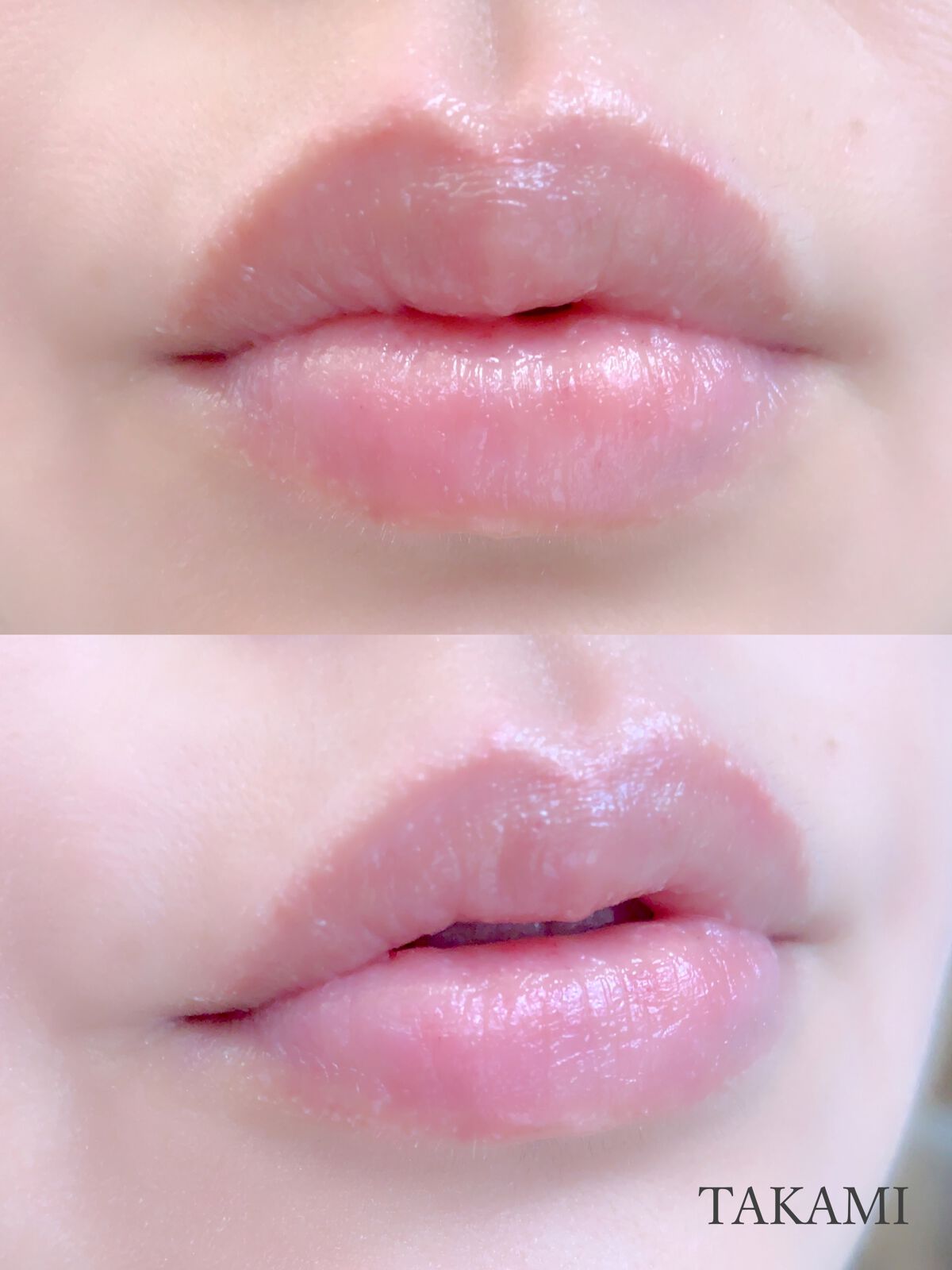 タカミリップ｜タカミの使い方を徹底解説 唇もスキンケアしてみませんか？ by Mee❤︎(乾燥肌) LIPS