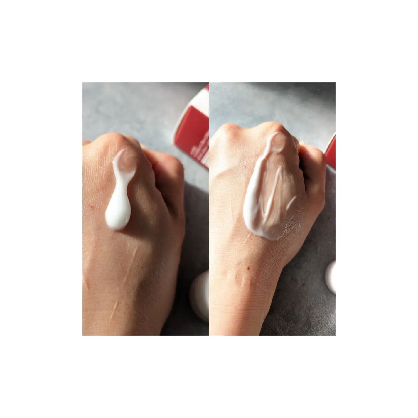 アキュリアルナインコントロールエックスクリーム/ACWELL/フェイスクリームを使ったクチコミ(6枚目)