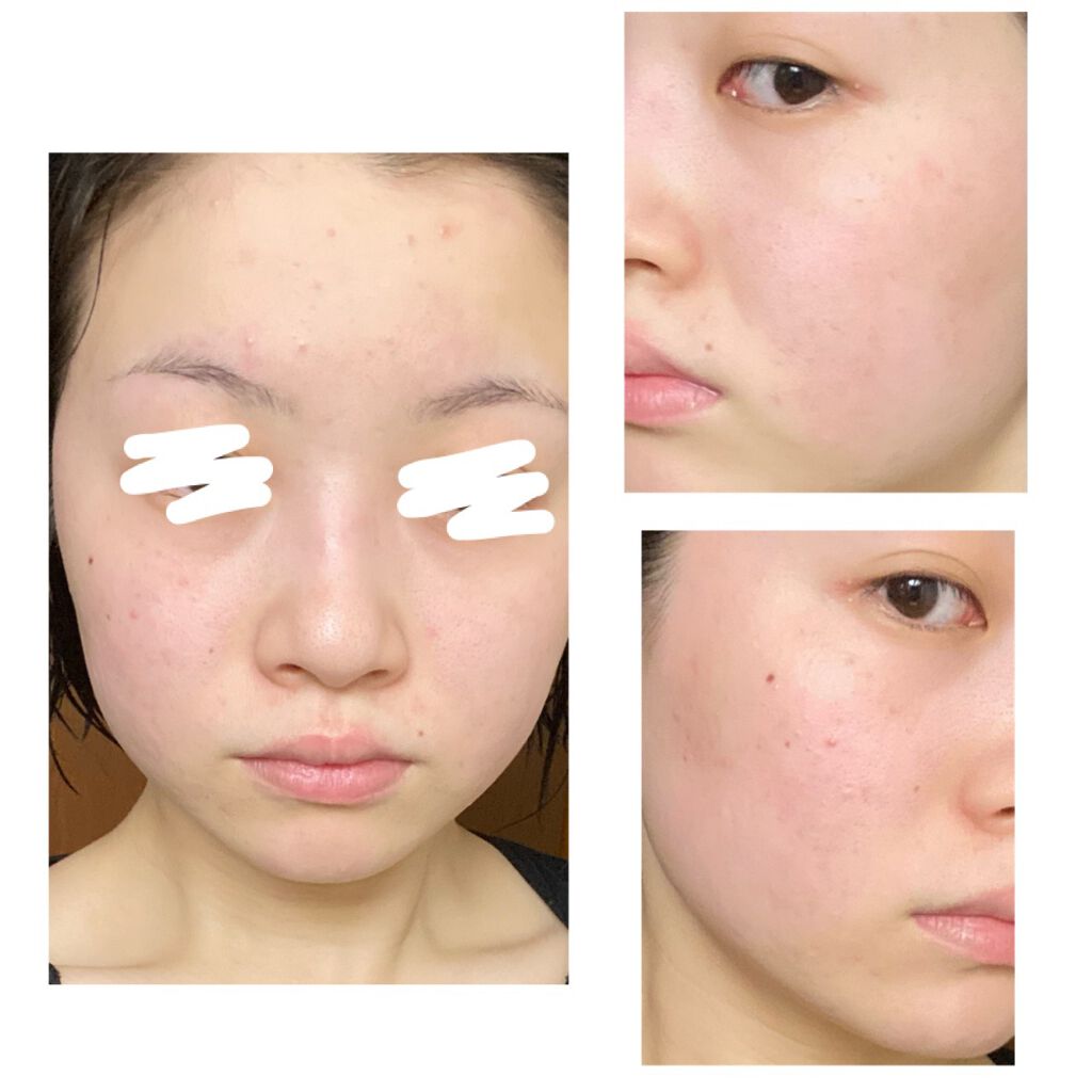 薬用しみ対策 美白化粧水 しっとりタイプ/メラノCC/化粧水を使ったクチコミ（1枚目）