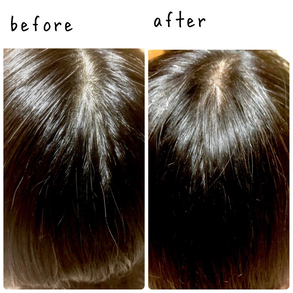 カラートリートメント/サイオス/ヘアカラーを使ったクチコミ（2枚目）