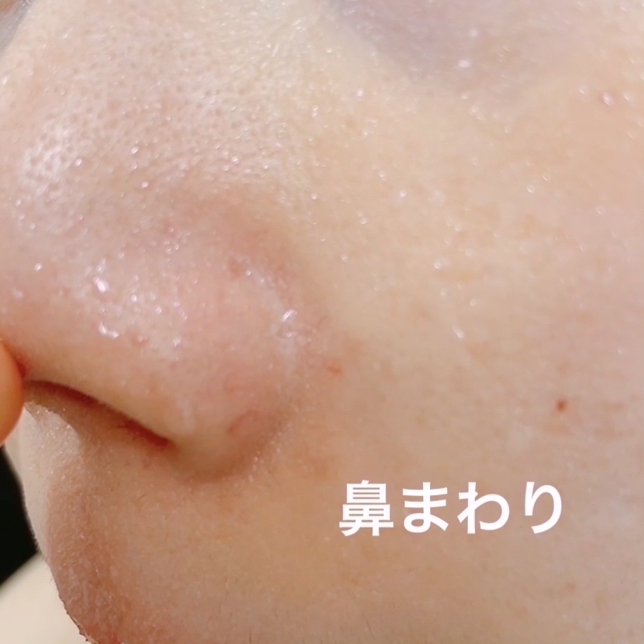 &amp;honey クレンジングバーム メルティ ホット/&amp;honey/クレンジングバームを使ったクチコミ（3枚目）